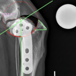 cirugía TPLO en perros
